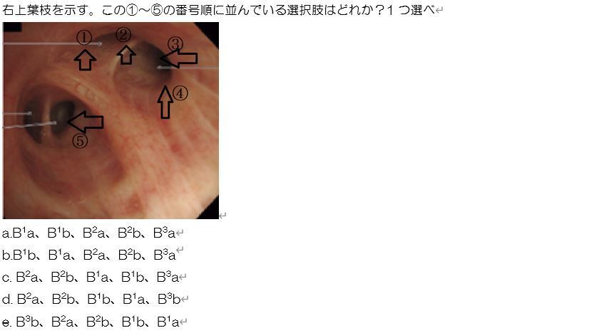裁断済み 気管支鏡“枝読み”術 - 健康/医学